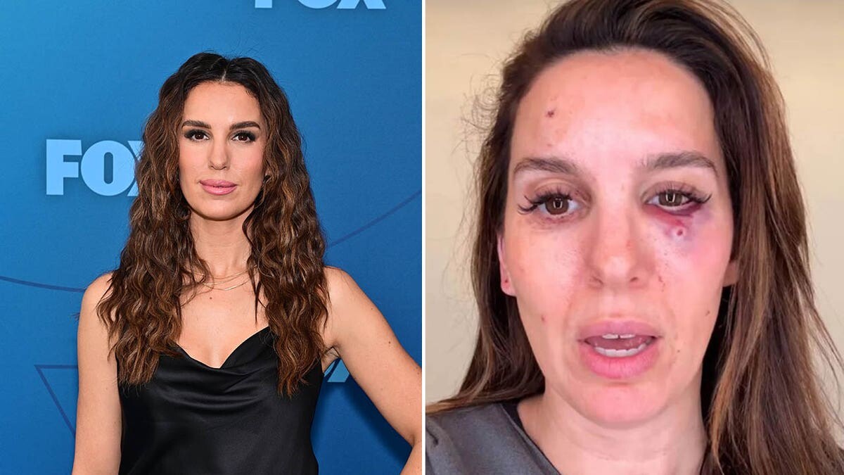 Former Disney star Christy Carlson Romano reveals shocking details about nearly losing her eye  at george magazine