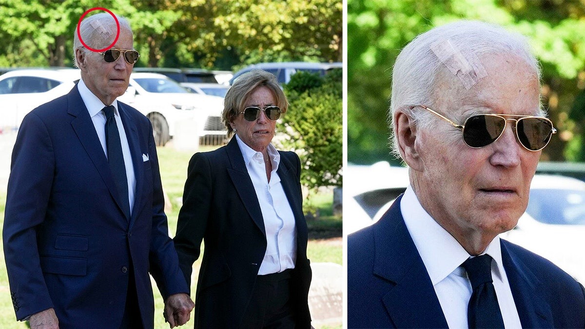 Biden spotted with giant bandage on head after having surgery to treat skin cancer  at george magazine