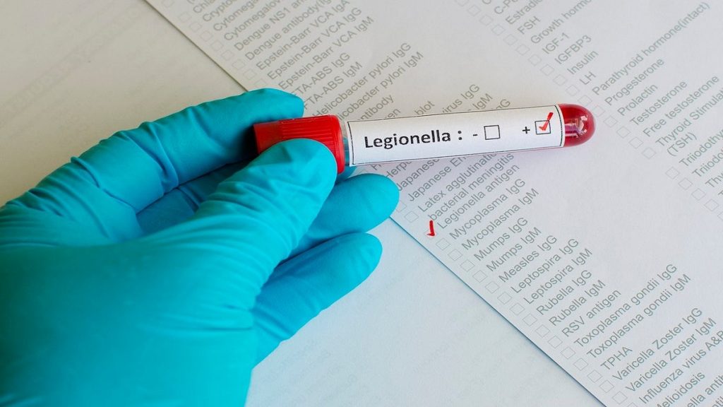 NYC Legionnaires’ disease outbreak kills fourth victim, 76 cases reported