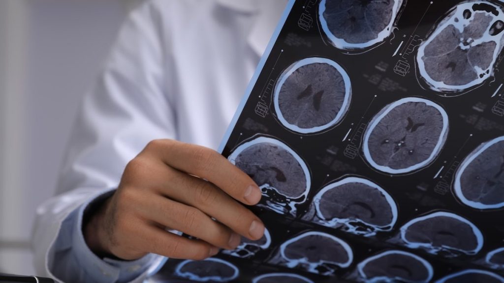 7 new dementia risk factors revealed — including one millions struggle with